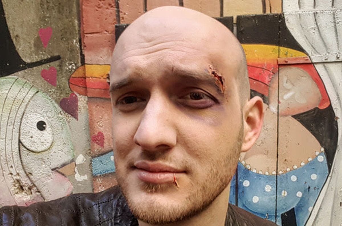 Pogledajte što je Marko Škugor spreman sve učiniti za ljubav