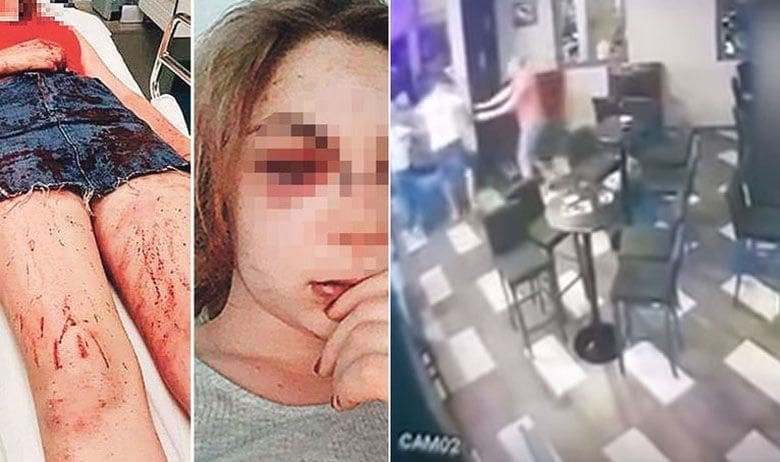 Slučaj pretučene djevojke u Zadru: Protiv četvorice policajaca stegovni postupci pred disciplinskim sudom u Splitu