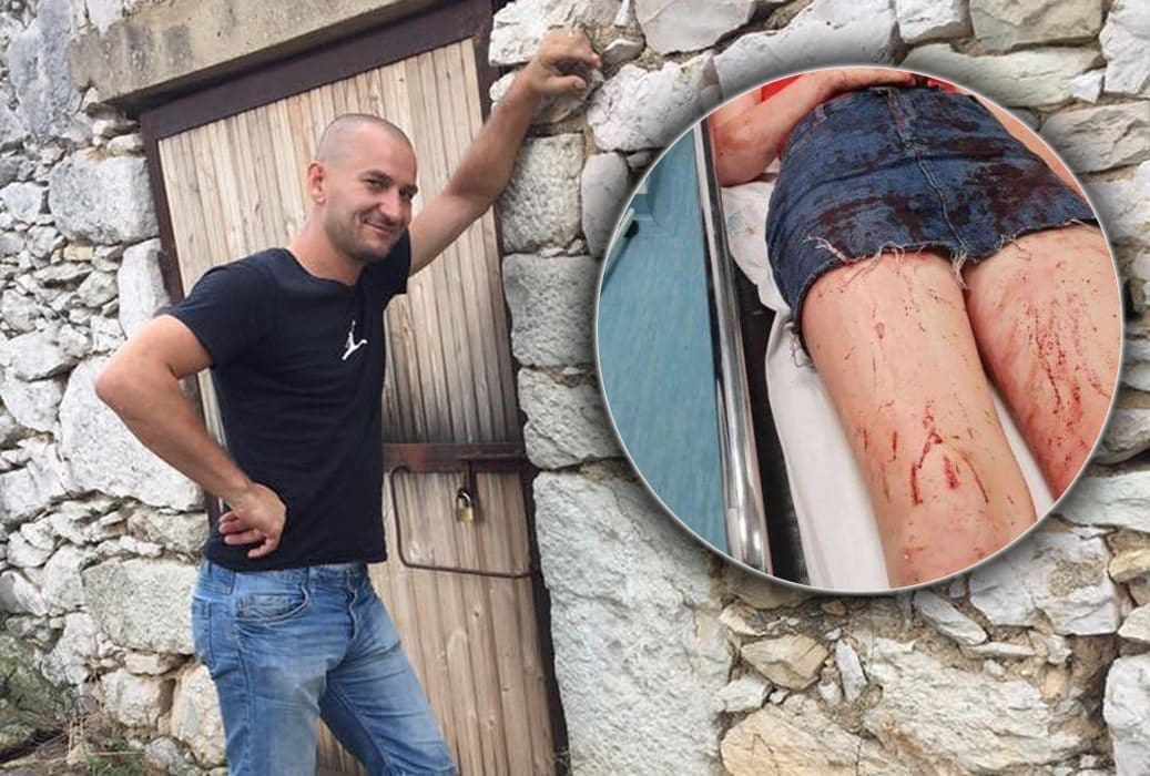 Zaštitnik brutalno pretučene Zadranke: "Raspituju se o meni. Nije pitanje hoće li biti krvi, već kad će se ona proliti"