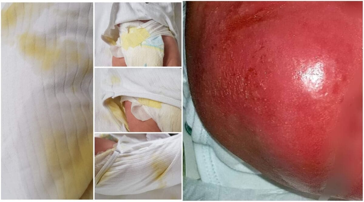 HOROR NA KLINICI ZA INFEKTIVNE BOLESTI Petomjesečni blizanci vezani za krevet i prepušteni sami sebi?