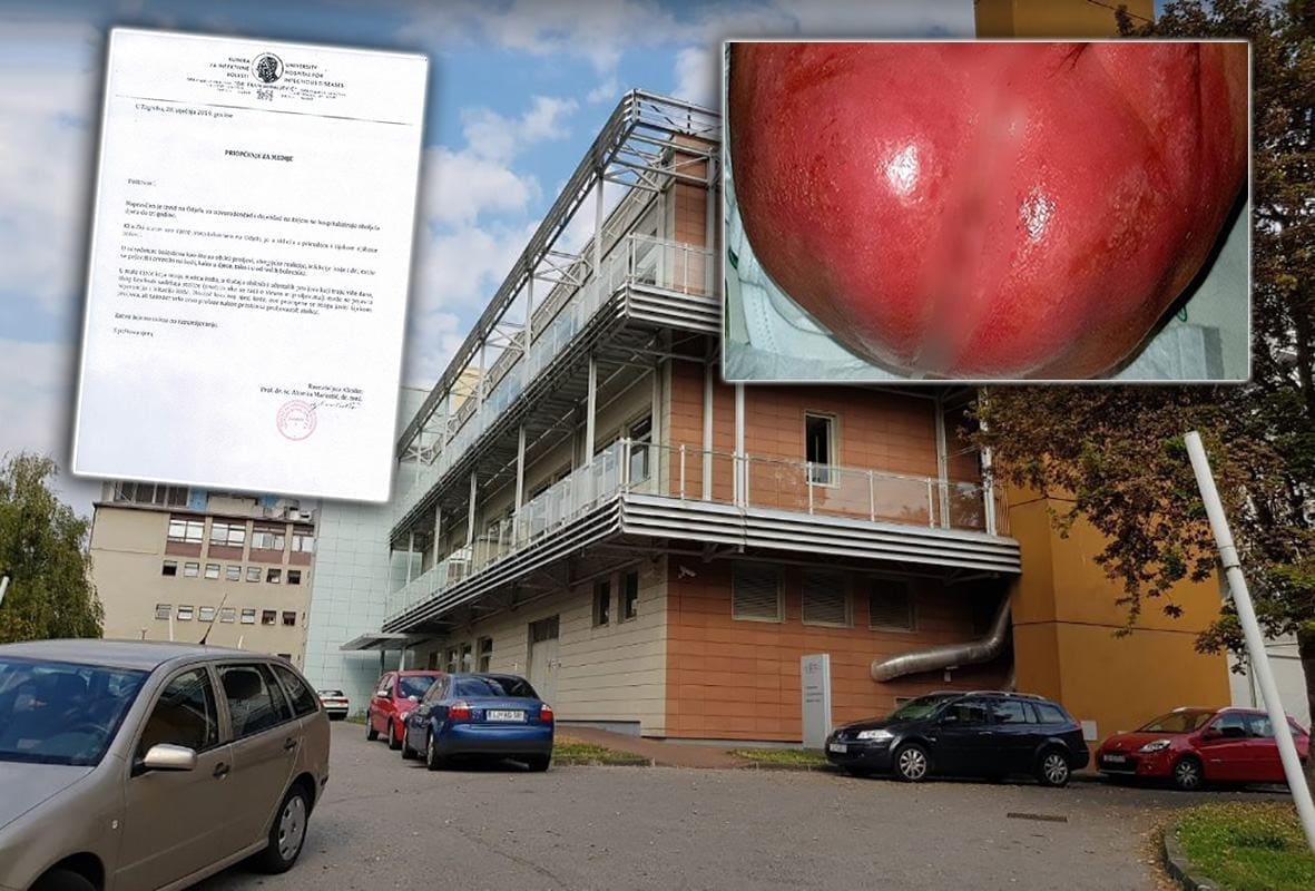 Stigao odgovor iz klinike za infektivne bolesti: "Status djece je u skladu s prirodom i tijekom njihove bolesti"