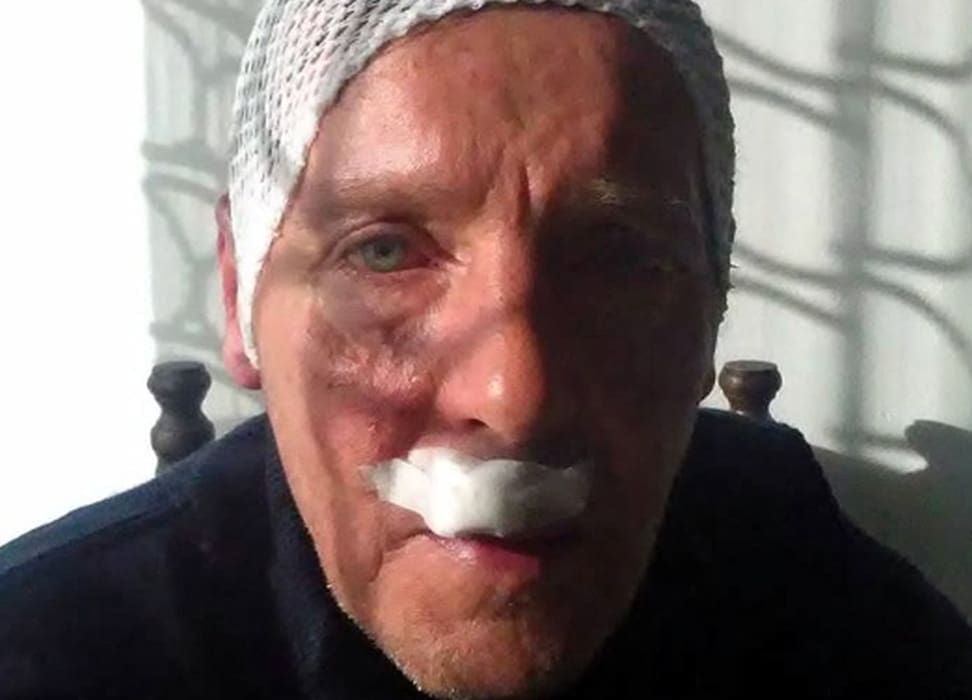 NAPAD ŠIPKOM Pogledajte kako izgleda pretučeni Prometov vozač: "Za mene je ovo pokušaj ubojstva"