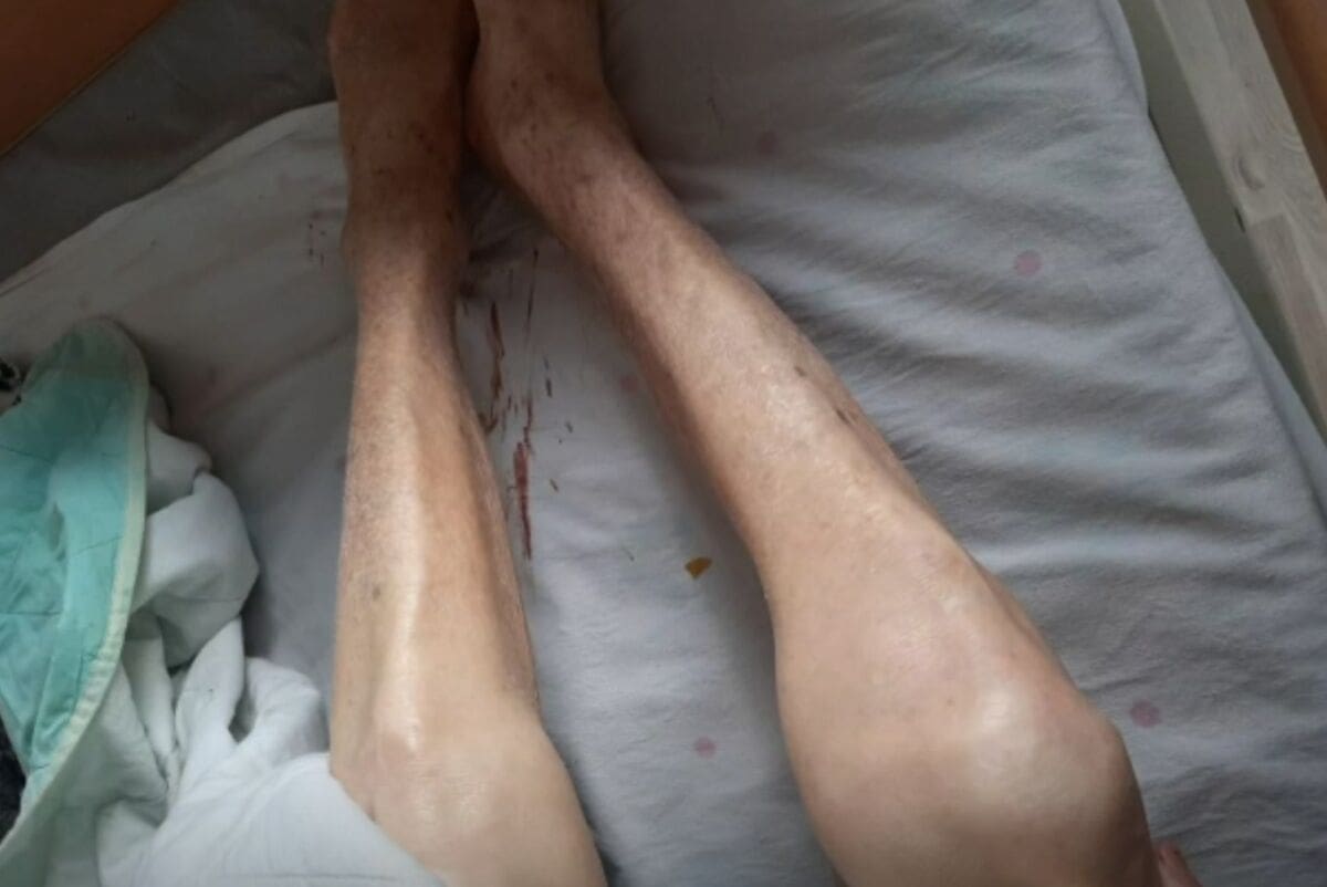 NOVI STRAŠAN SLUČAJ Domu zabranili rad, a i dalje radi: "Ljudi su u nehigijenskim uvjetima, doslovce puni fekalija"