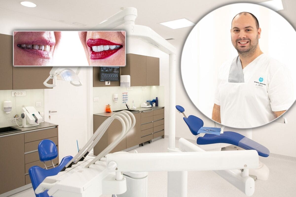 JEDNA OD NAJBOLJIH SPLITSKIH ORDINACIJA Hollywoodski osmijeh uz pomoć zubnih ljuskica