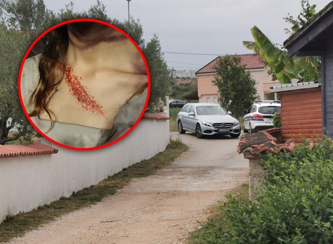 ŽENA KOJU JE NAPAO BRAT I CIPELARIO NA PODU "Premlatio me jer sam ga upozoravala da zapostavlja svoju djecu, moje nećake!"