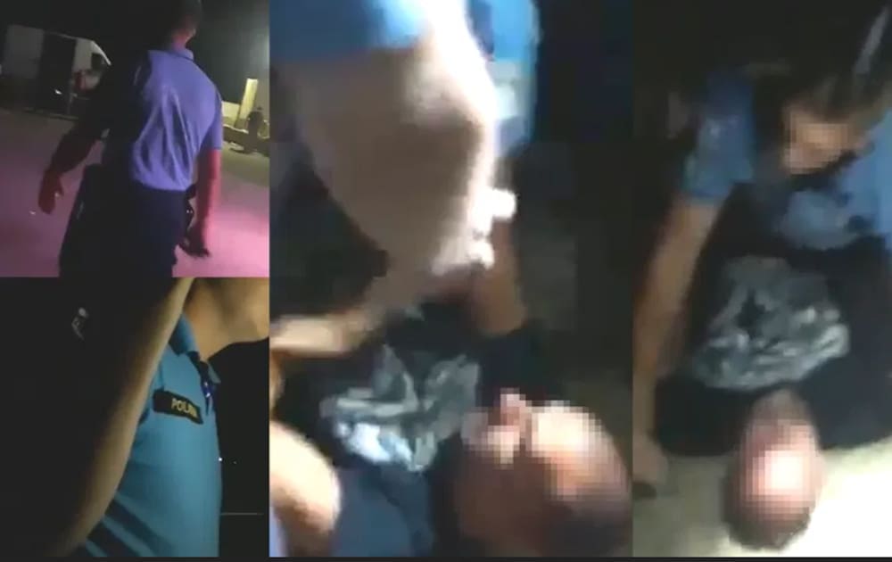 DRUGA STRANA PRIČE Policajac brutalno prebio mladića zbog ekavice?