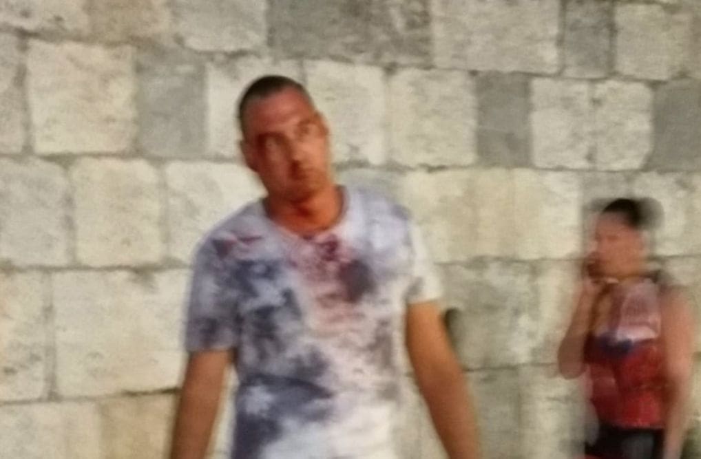 Čovjek cijeli u krvi u Marmontovoj šokirao prolaznike