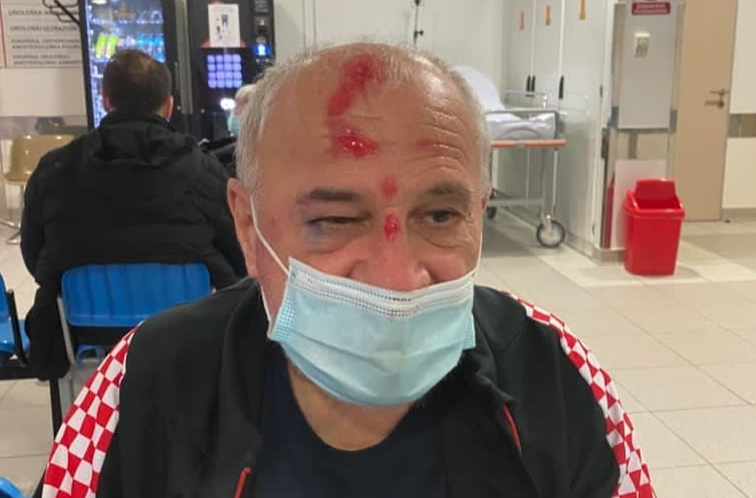 Šetača Bandićevog psa napao muškarac na ulici, gurnuo ga je i teško ozlijedio