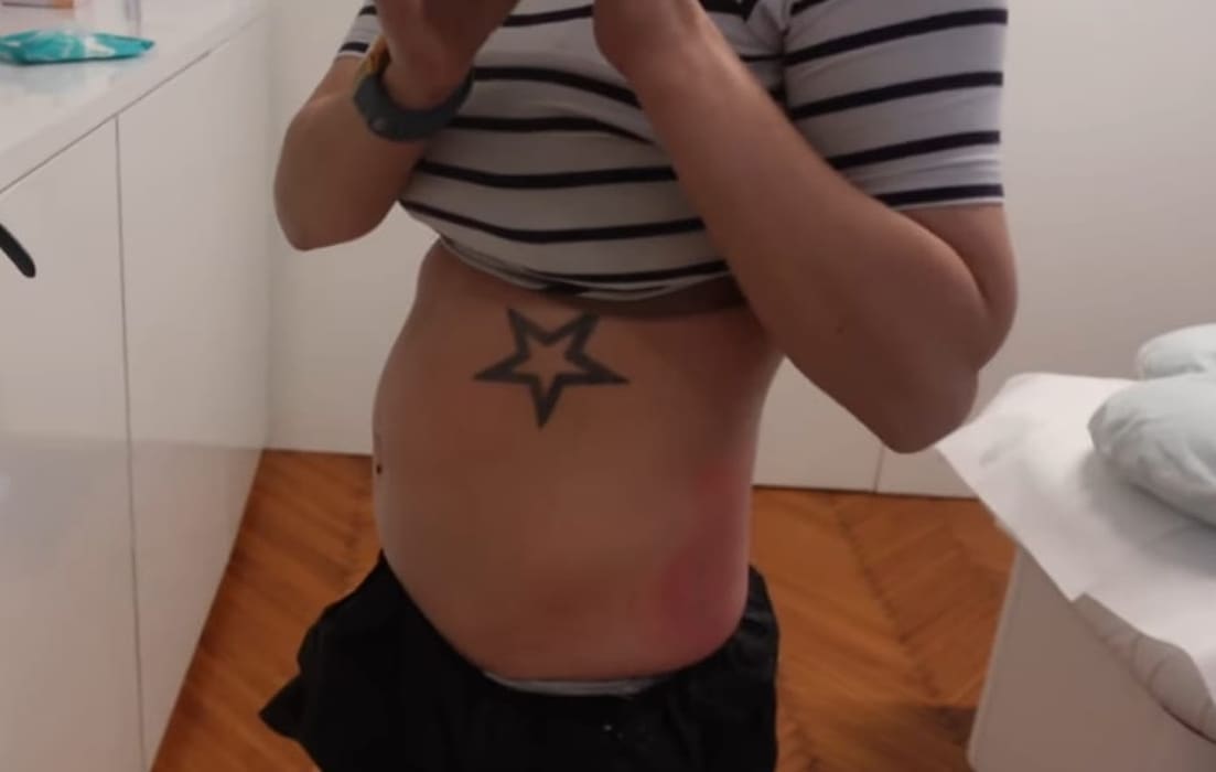 Ella se pohvalila novim estetskim zahvatom: "Inače se treba čekati tri mjeseca, ali mislim da bolje od ovog ne može"