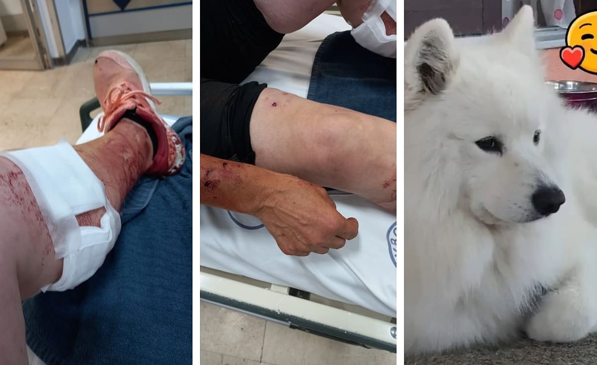 KRVOLOČNI NAPAD VUČJAKA Srinjanku i njenog psa izgrizao susjedov pas. Vlasnik: "Možda je moja jedina greška što je kapija bila otvorena"