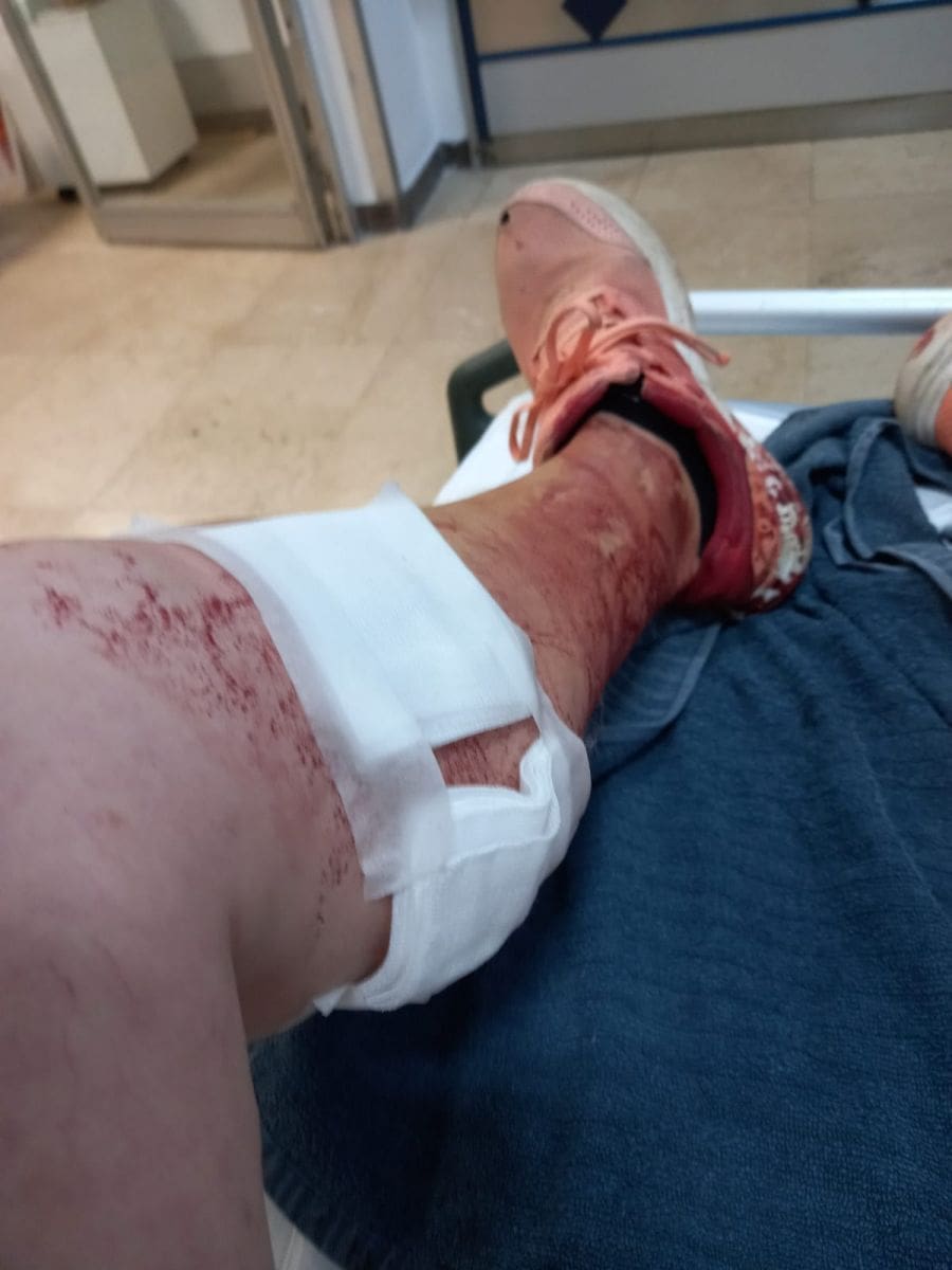 napad_samojed_messi(4)