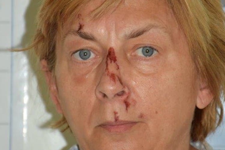 NEKAD USPJEŠNA DIZAJNERICA NAKITA Ženi koja je bez pamćenja pronađena na Krku, obitelj okrenula leđa