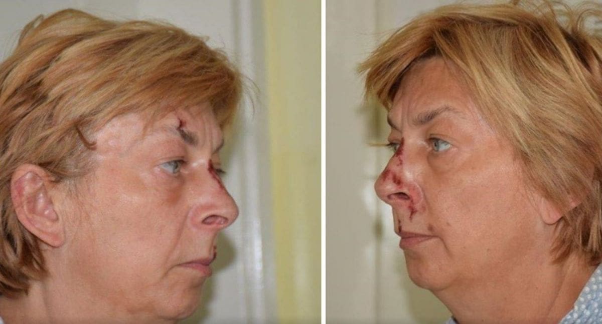 Na Krku je prije devet dana pronađena žena: Policija pronašla ruksak s važnim detaljem