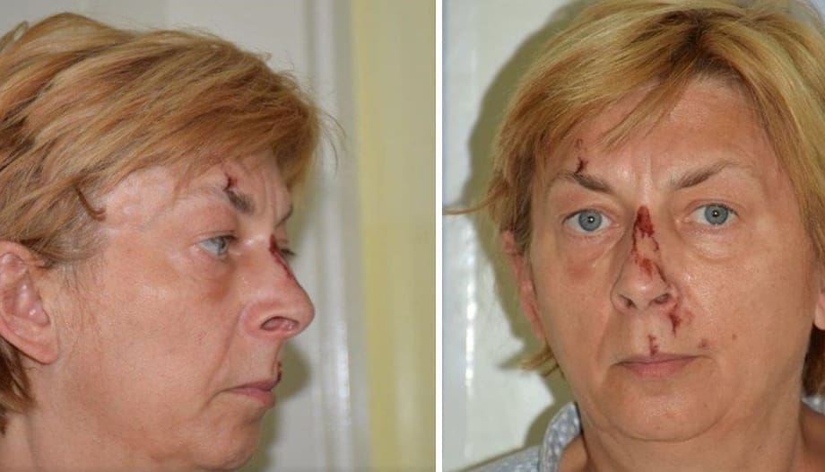 PREPOZNAJETE LI OVU ŽENU? Pronađena je na Krku, ozlijeđena je i ne zna tko je