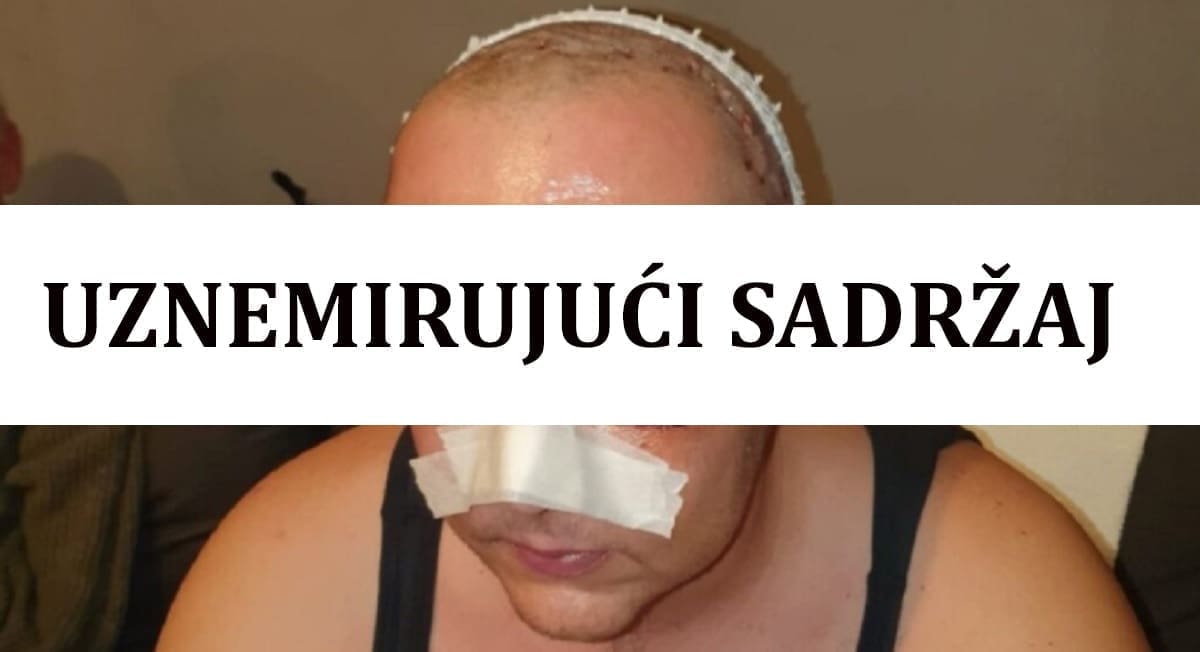 "Hoćeš li možda da ti pustimo Thompsona?": Prebili mladića (28) jer je želio čuti Škorinu pjesmu