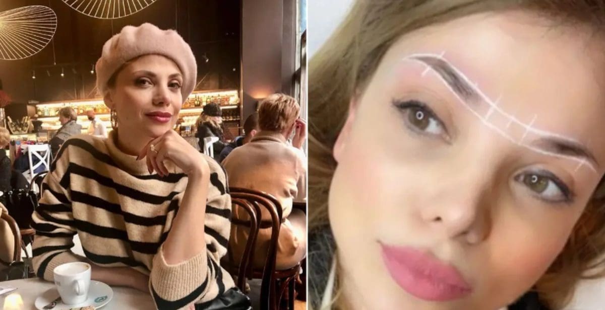 POSVEĆUJE PUNO PAŽNJE IZGLEDU Lejla Filipović pokazala rezultat novog estetskog tretmana: 'Dugo sam razmišljala o ovome'