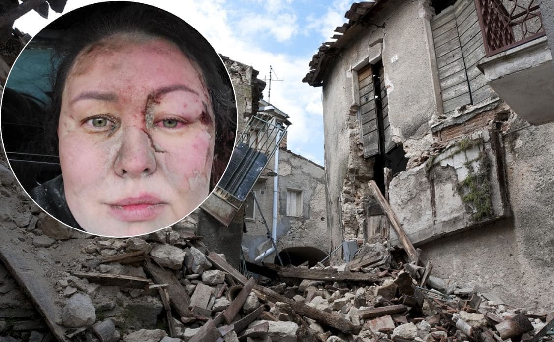 Stravična priča ukrajinske trenerice koja je zamalo stradala u ruševinama: "Mislila sam da ću umrijeti živa zakopana"