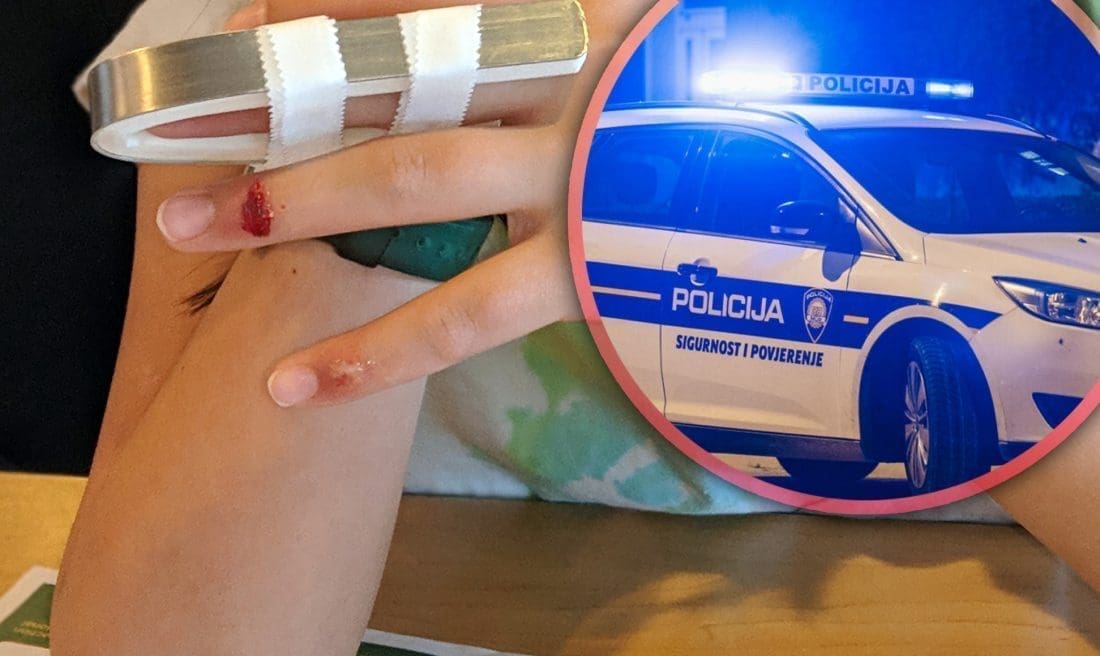 UHIĆEN JE Hrabra Splićanka krenula zaustaviti lopova koji je pokrao dućan. On je napao i ozlijedio