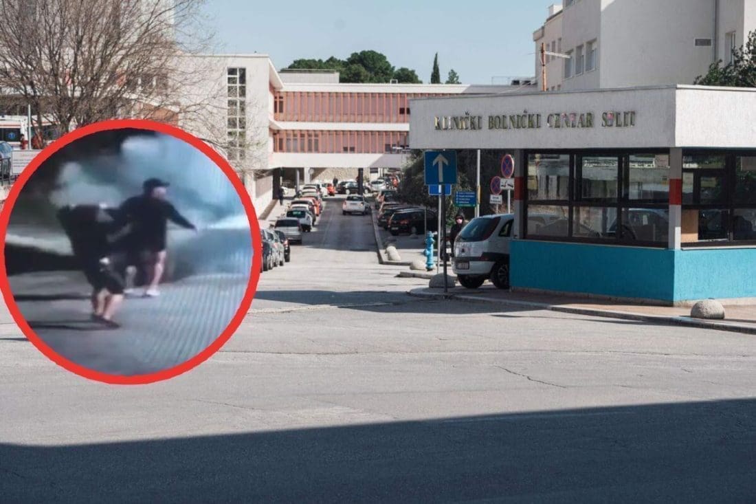 DVA NAVIJAČA RANO JUTROS PRIMLJENA U SPLITSKI KBC Šef kirurške službe održao izvanrednu konferenciju za medije te izvijestio o kakvim se ozljedama radi