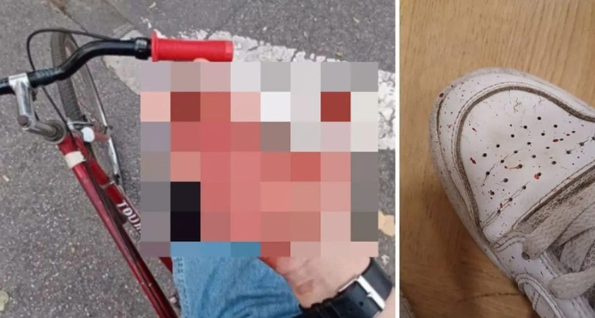 ŠTO SE STVARNO DOGODILO? Čovjeku pala cigla na glavu, policija sve demantira: "Zabio se romobilom u postavljenu skelu"