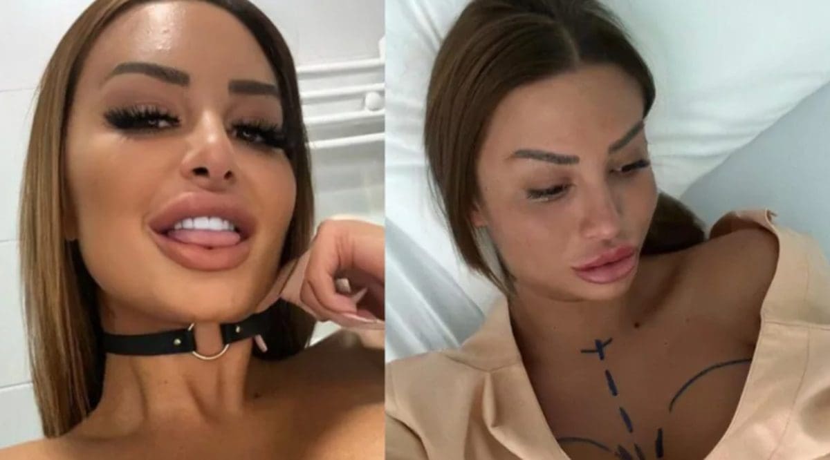 SEZONA NJENOG VOĆA Kristina Mandarina opet operirala grudi: "Operacija je prošla odlično, uskoro ću na štand"