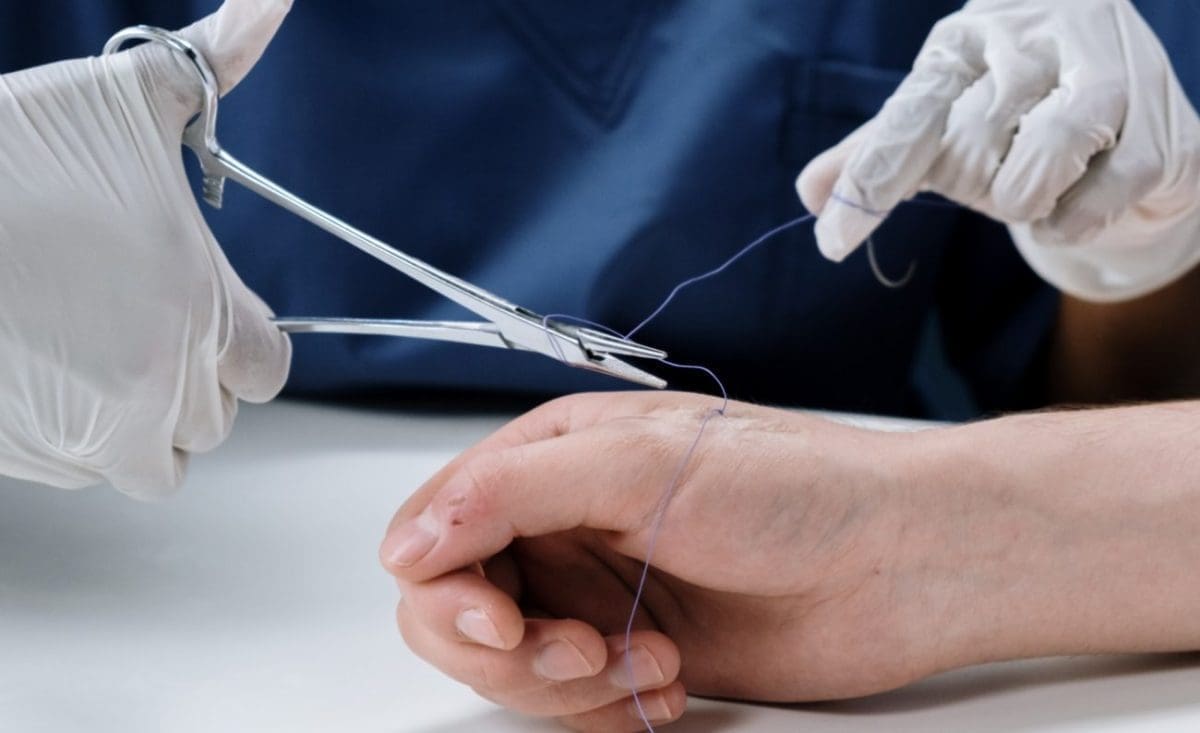 UŽAS NA HVARU Muškarac orezivao stablo električnom brusilicom, zadobio ozljede opasne po život