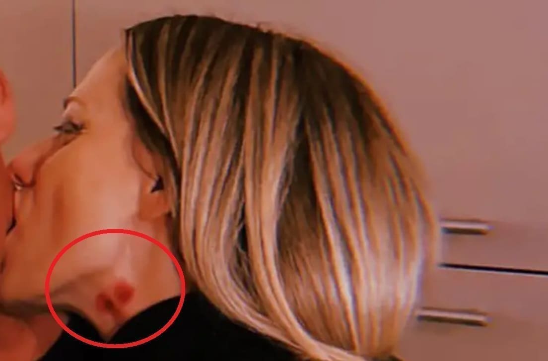 ŠTO LI JOJ SE TO POJAVILO? Jelena Veljača na vratu ima podljev: Fotografiju objavila na društvenim mrežama...