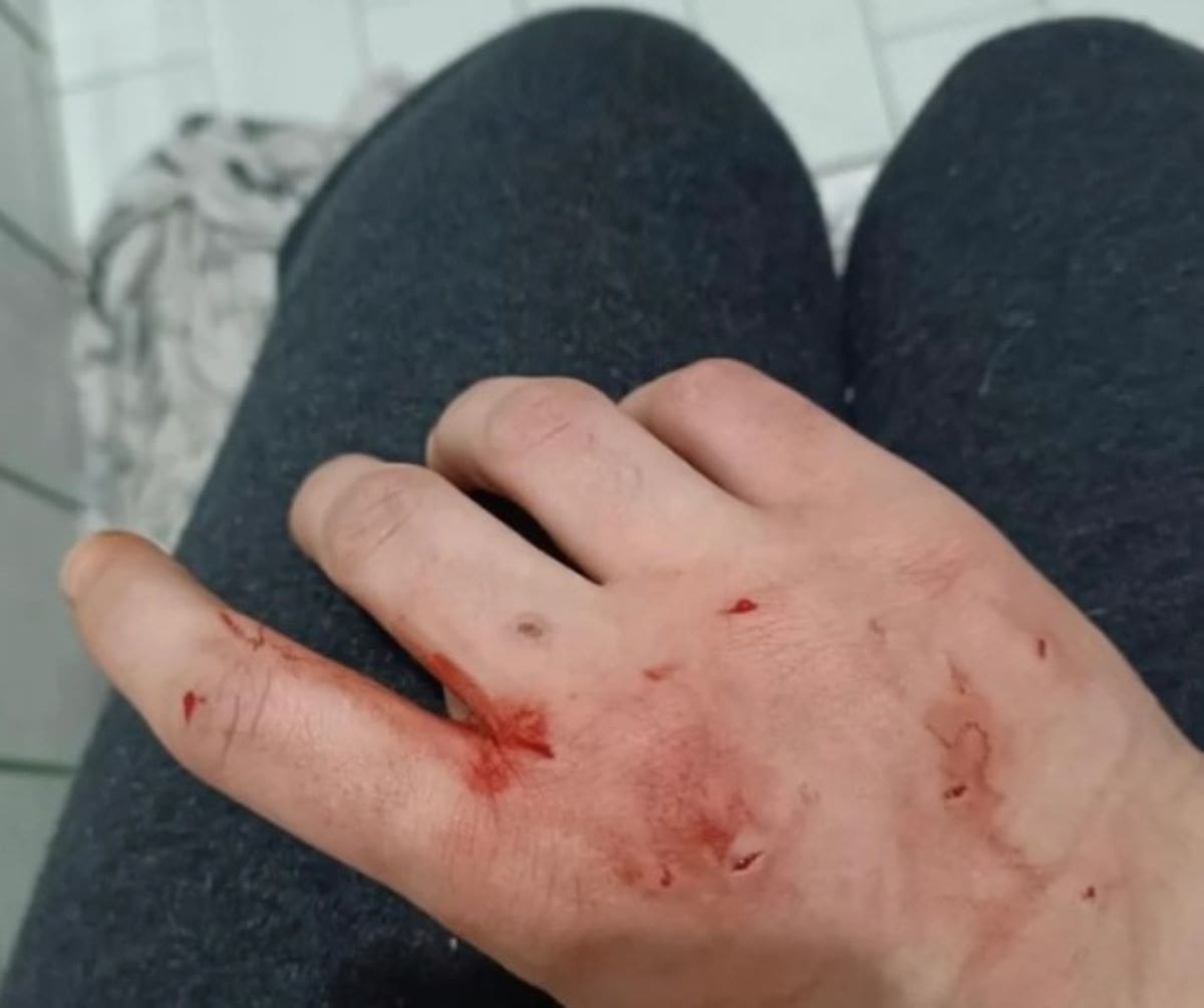 SCENE IZ HOROR FILMA Ženu napala njena mačka dok je spavala: Cijela je izgrižena i u modricama