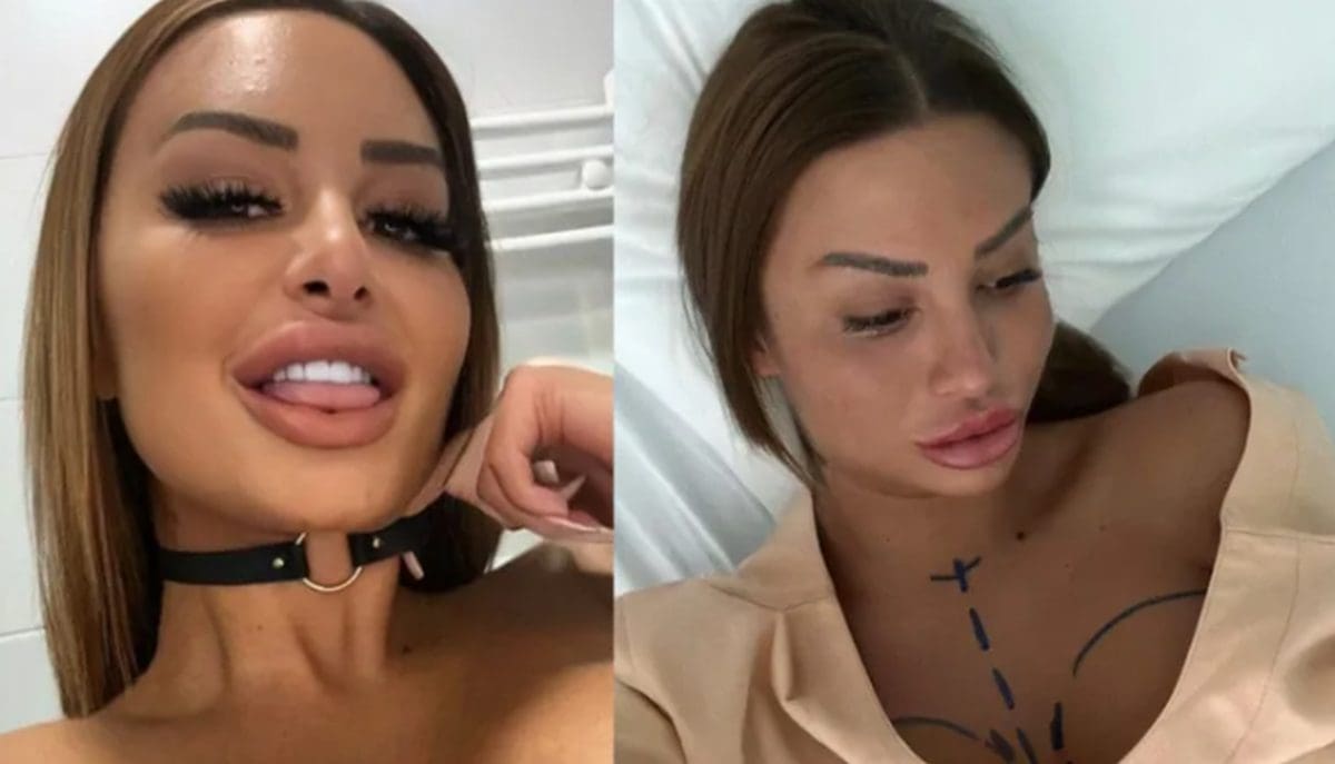 Kristina Mandarina otkrila da je bila na novoj estetskoj operaciji: "Vraćam se na štand prodavati mandarine"