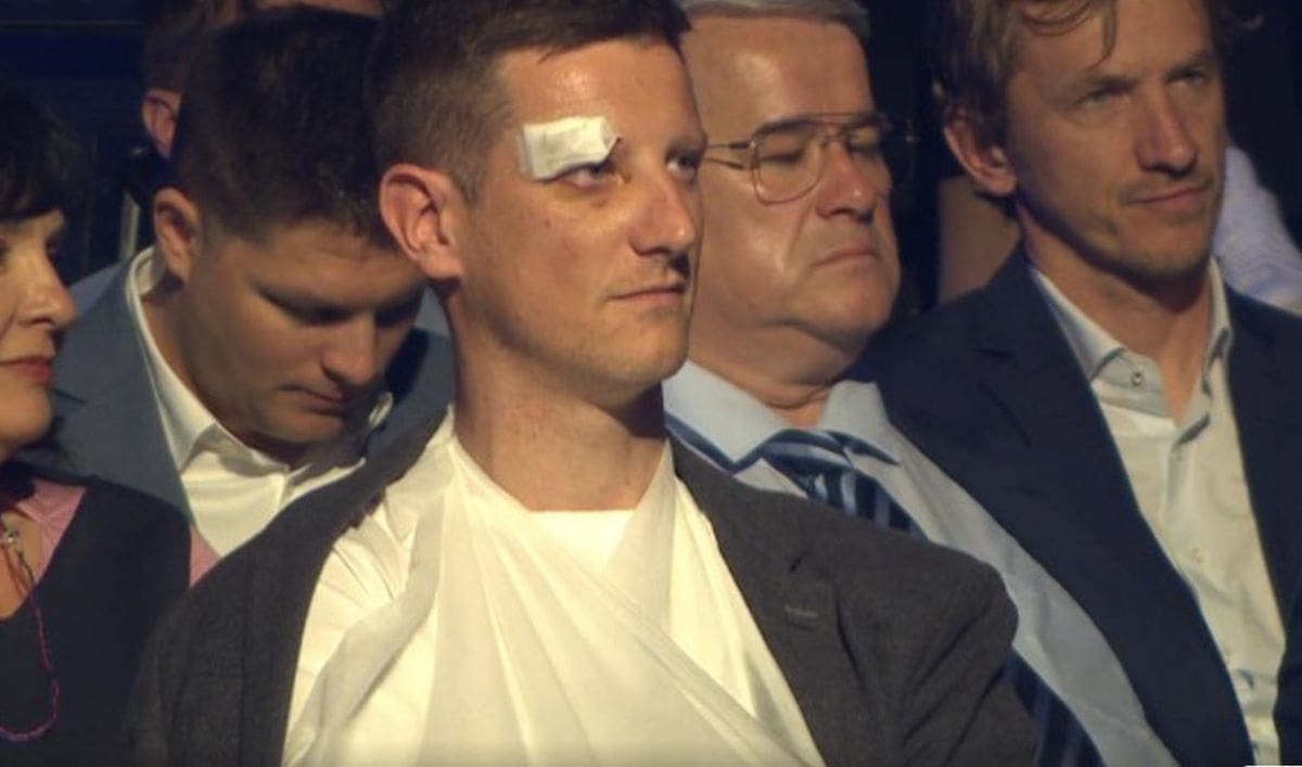 ZABRINUO GLEDATELJE Novinar HRT-a u emisiju se javio sa slomljenom rukom i modricama na glavi