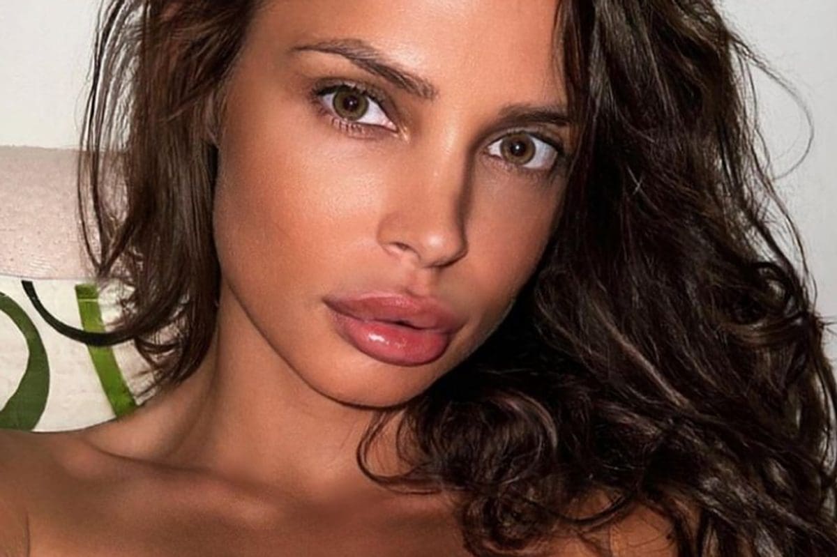 UZNEMIRUJUĆE Starleti iz susjedstva slomljene kosti lica, objavila slike iz bolnice: "Pretukao me dečko"