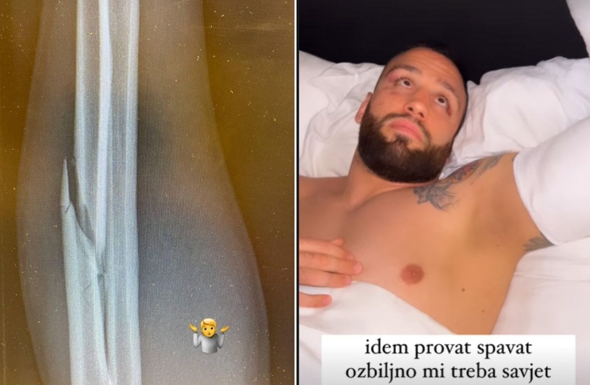 JUNAČKA BORBA Plazibat nakon teškog poraza uputio ispriku HNS-u: 'Nisam to namjerno napravio'