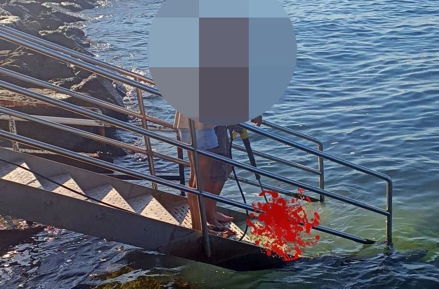 APEL KUPAČA SA ZENTE Splićanin šmrkom ispirao krv sa stepenica 'Treba