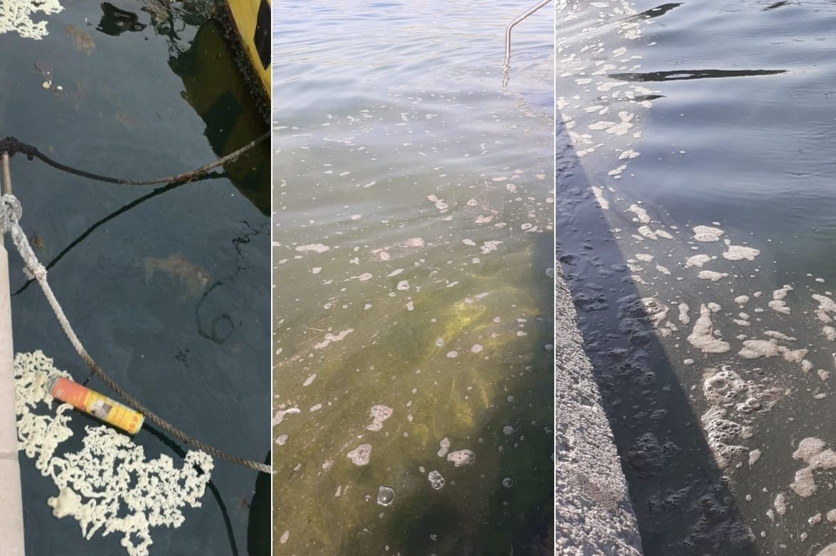 NIJE ZA SVAČIJI ŽELUDAC Vranjičani upozoravaju: 'Djeca nam pobolijevaju od enterovirusa i slatkih krasta'