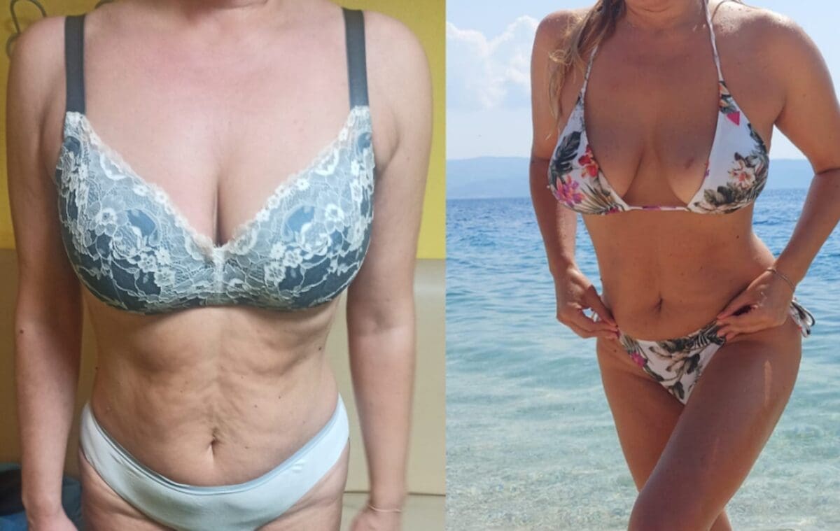 SPLIĆANIN OBJAVIO FOTOGRAFIJU I IZAZVAO NEVIĐENU LAVINU REAKCIJA Jesu li na fotografijama iste osobe? Dalmaciji Danas se javio trener žene: "Aktivno i iscrpno radimo više od dva mjeseca"