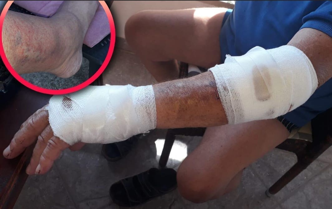 BRUTALNI SUKOB NA HVARSKOM PARKINGU "Pregazio me autom, oteo mi ključeve". Policija: "Izvijestili smo Državno odvjetništvo"