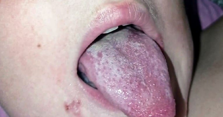 DRAMA U HRVATSKOJ Dječak popio sok u kafiću i završio na infuziji: Unutra bila opasna lužina?