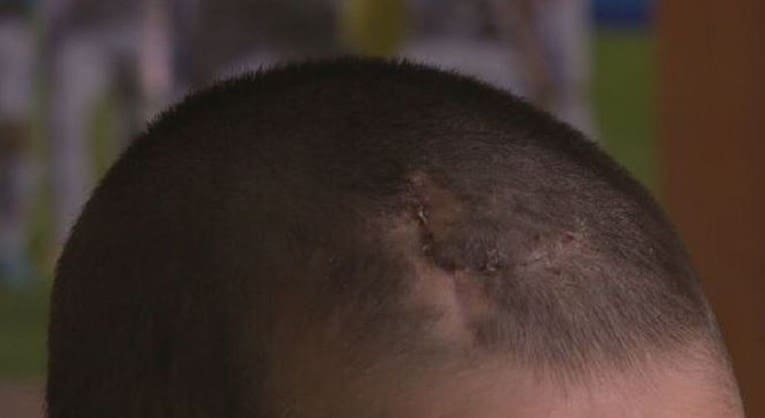 Dječaku tijekom igre pao gol na glavu