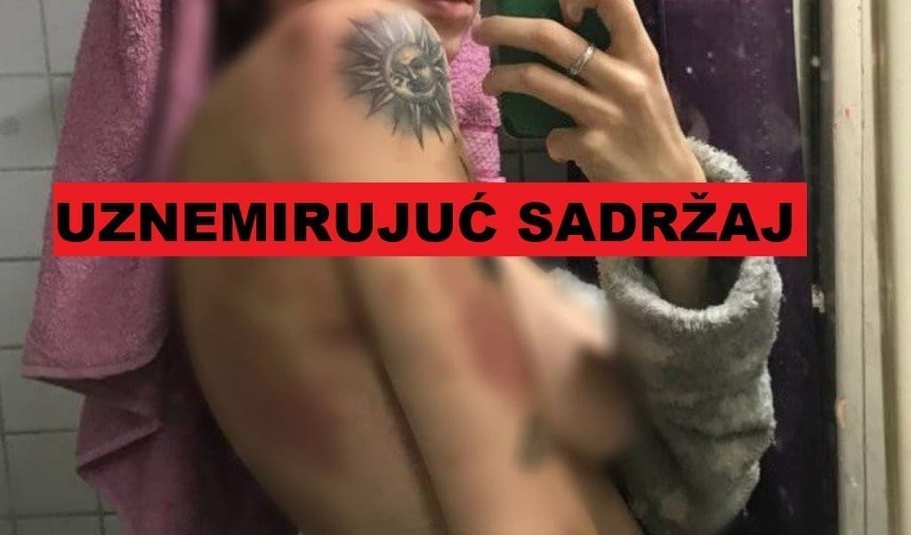 HOROR U SUSJEDSTVU Brutalno pretučena Ruskinja pomoć traži na društvenoj mreži: "Nemam kako napustiti zemlju..."