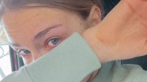 NAŠA PJEVAČICA SE SLOMILA PRED KAMERAMA: "Cijeli život nisam dobro, ja sam jako tužna osoba"