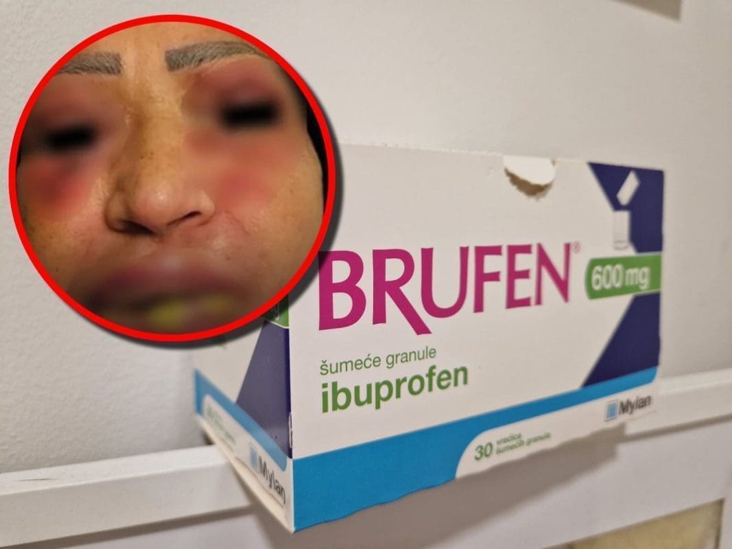 Uzela ibuprofen kako bi izliječila gripu, doživjela neočekivane nuspojave: "Niti jedan lijek nije moguće uzeti bez određenog rizika"