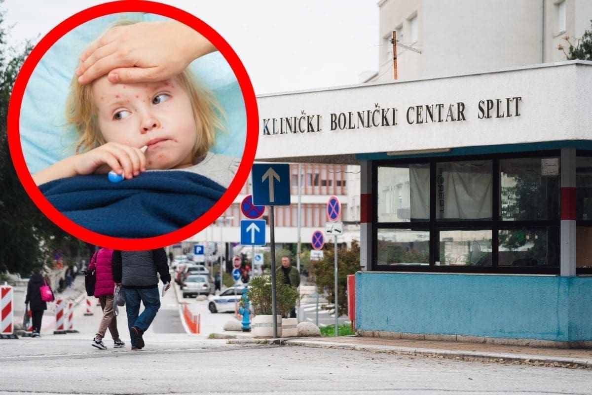 HZJZ OBJAVIO SAVJETE U Hrvatskoj do lipnja 18 zaraženih ospicama: "Ne odgađajte cijepljenje"