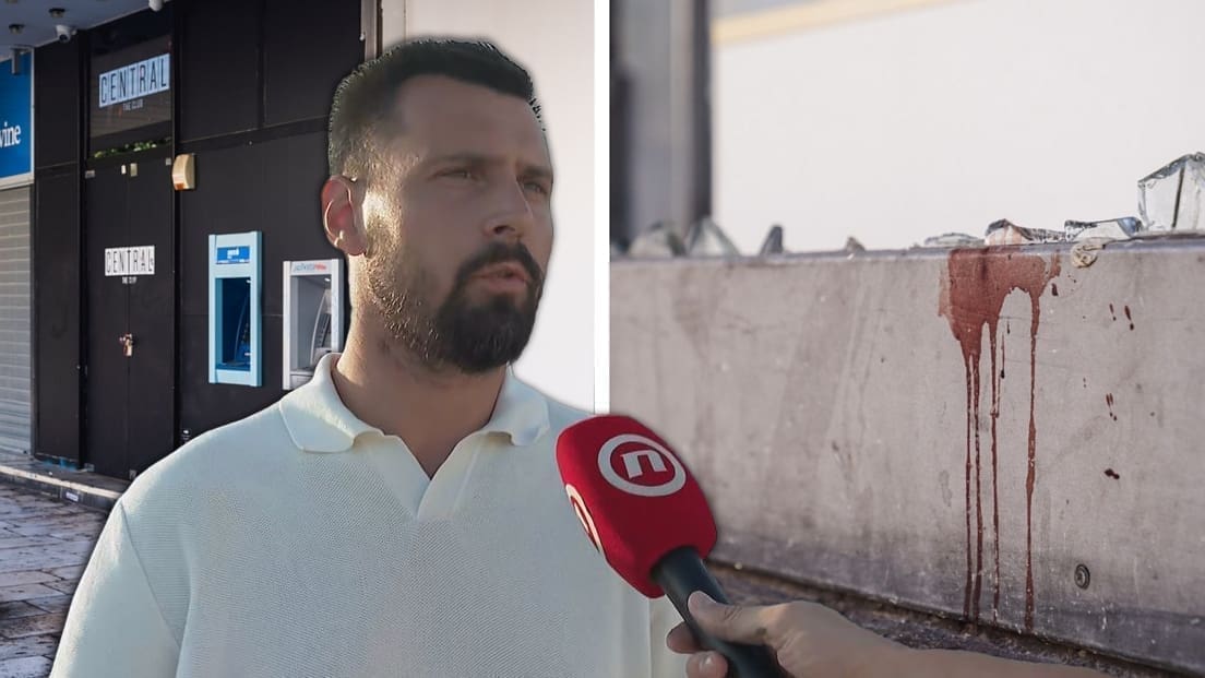 Ivošević o nesreći s puknućem stakla: Pijana mladost koja je pokušavala ili nije mogla ući u klub zbog svoje dobi