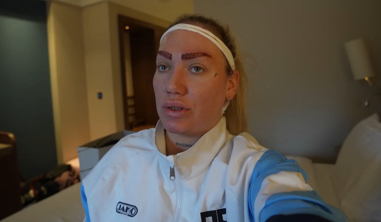 Ela Jerković šokirala novim estetskim zahvatom: "Vlastita baka je neće prepoznat"