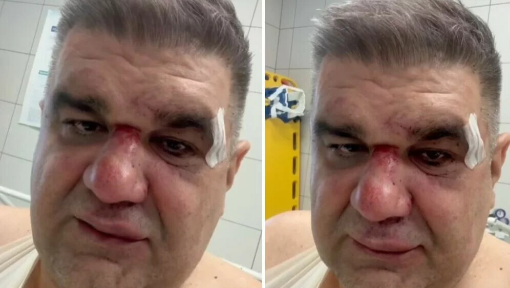 VIDEO Javio se pretučeni srpski menadžer: "Napao me s leđa, šutirao me u glavu..."