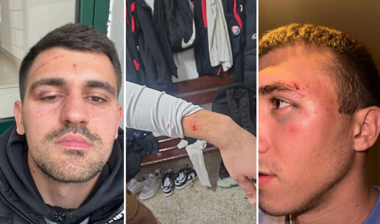 Brutalan napad na igrače ONK Metković u Orebiću