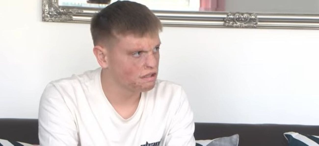 HRVATSKA SE UJEDNILA Kao beba zadobio je teške opekline u požaru: “Samo želim izgledati kao druga djeca”