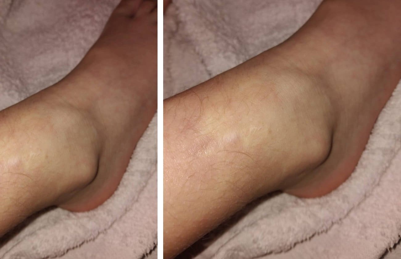 Za Maris dosad prikupljeno 2.200 eura, cilj je 5.000: Humanitarna akcija i dalje traje