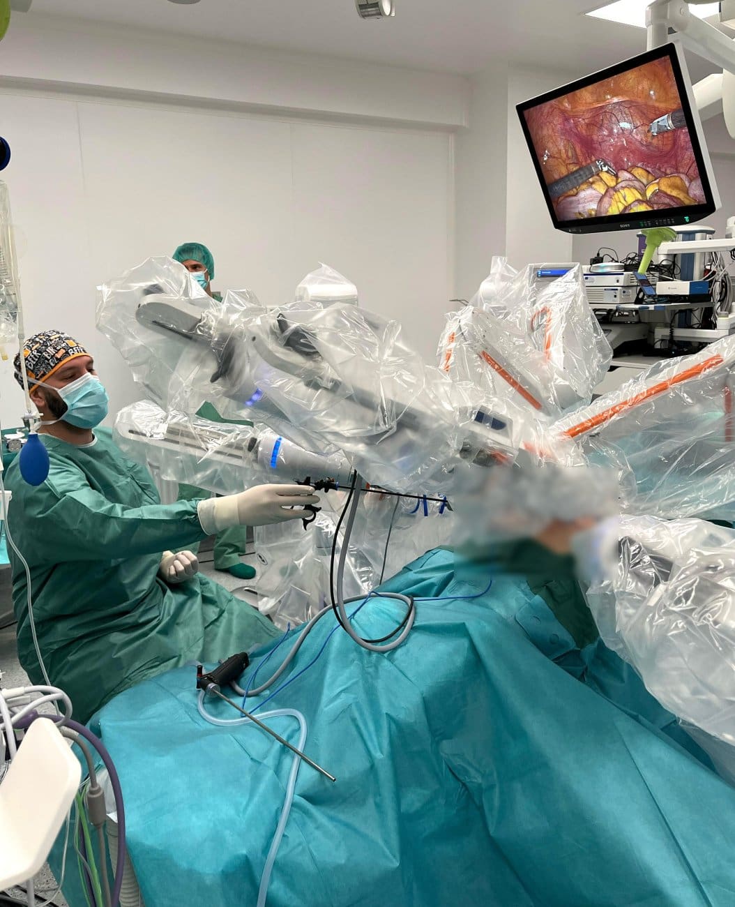 kbc split operacija robot fpto press 1