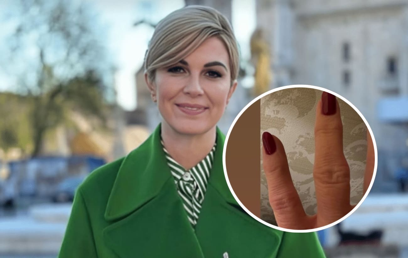 Ovo je ruka Kolinde Grabar-Kitarović. Evo što joj se dogodilo